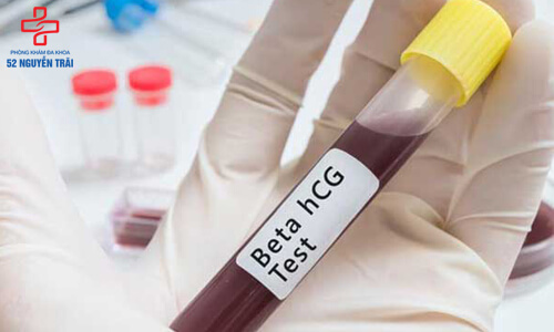 xét nghiệm máu giúp phát hiện giới tính thai nhi sớm