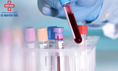 10 điều về xét nghiệm máu bác sĩ không nói cho bệnh nhân
