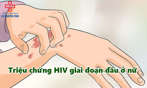 triệu chứng HIV giai đoạn đầu ở nữ